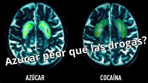 ¿qué Hace El Azúcar Con Nuestro Cerebro