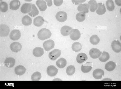 Parasite Plasmodium Vivax Fotografías E Imágenes De Alta Resolución Alamy