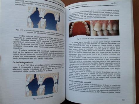 Ioan Sarbu Curs Practic De Implantologie Orala Cump R