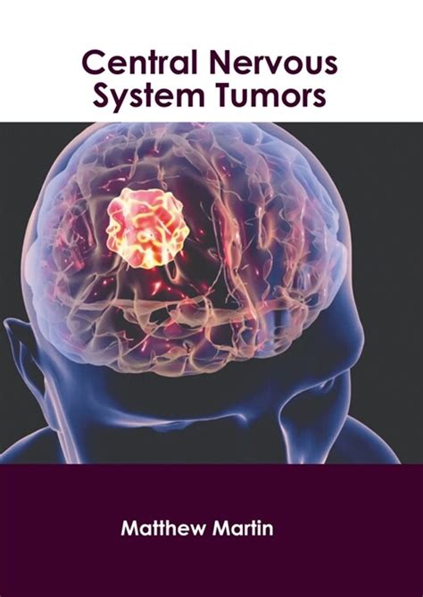 알라딘 Central Nervous System Tumors Hardcover