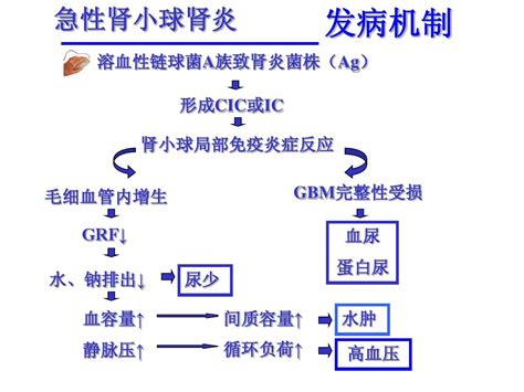 小儿急性肾小球肾炎 word文档在线阅读与下载 无忧文档