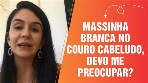 MASSINHA BRANCA NO COURO CABELUDO DEVO ME PREOCUPAR YouTube