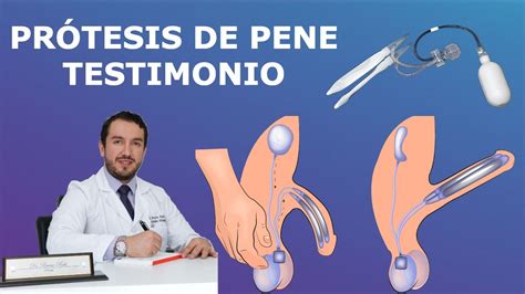 Protesis De Pene Testimonio Disfuncion Erectil Youtube