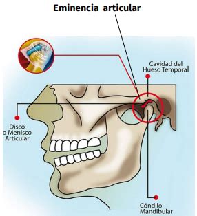 Articulaci N Temporomandibular Atm Mapa Mental