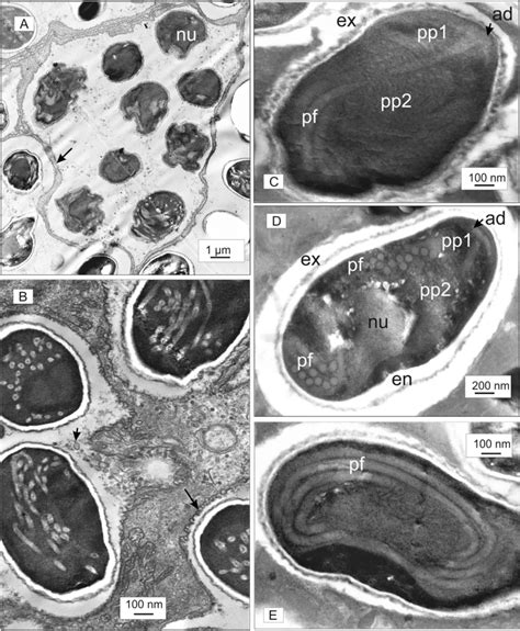 Ae Ultrastructure Of Late Sporogonial Stages And The Spores A