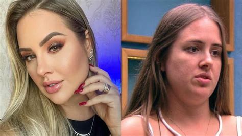 Ex Bbb Patr Cia Leitte Revela Trauma Ap S Procedimento Est Tico Sofri