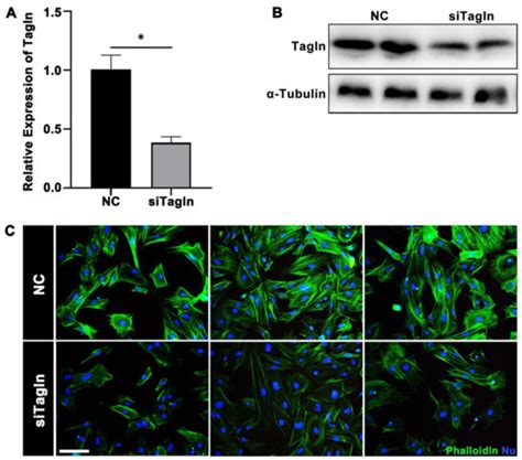 IJMS Free Full Text Molecular Mechanism Of Mouse Uterine Smooth