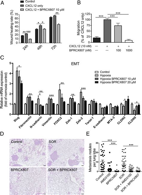 A Highly Selective And Potent Cxcr Antagonist For Hepatocellular