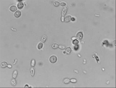 Giardia Cyst In Fecal Float