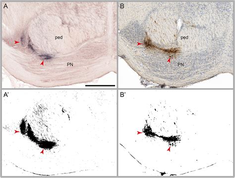 Frontiers Brain Wide Mapping Of Axonal Connections Workflow For