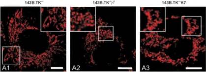 Mitochondrial organization in wild type and ρ0 143B TK cells The