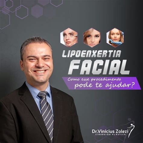 LIPOENXERTIA FACIAL COMO FUNCIONA Dr Vinicius Zolezi