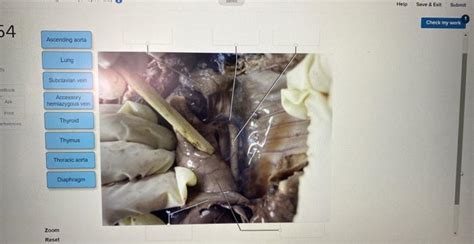 label the parts | Chegg.com 