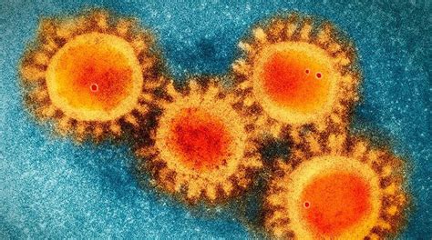 Coronavirus origen transmisión causas síntomas protección