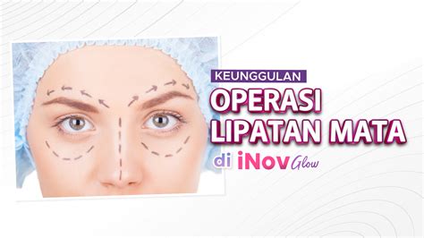 Keunggulan Operasi Lipatan Mata Di Inov Glow INOVGLOW KLINIK