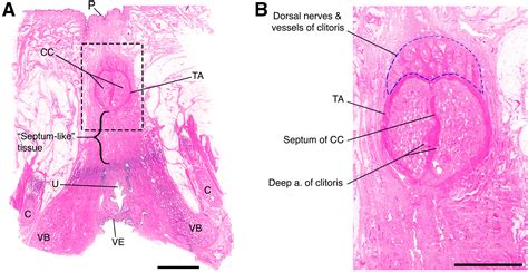 Anatomic Relationships Of The Clitoral Body Bulbs Of The Vestibule And Urethra American