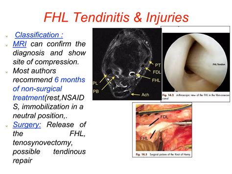 Medial ankle pain | PPT