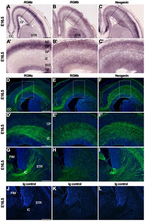 In Situ Hybridization AC And Immunohistochemistry DL On Coronal