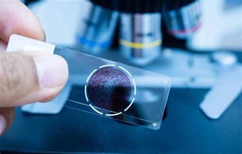 pathology  yashwant hospital expert care  dr anil vishnu patil