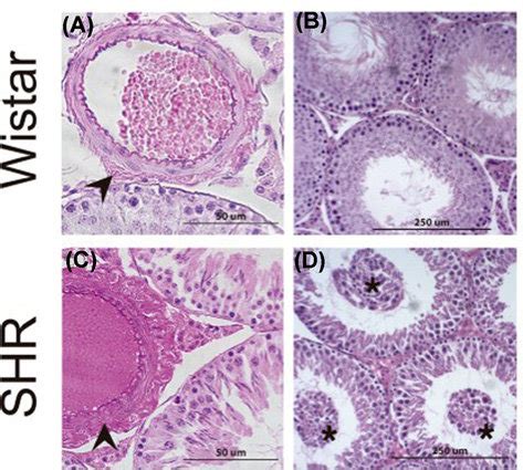 Hematoxylin And Eosin Staining Of Testis From Normal And Spontaneously