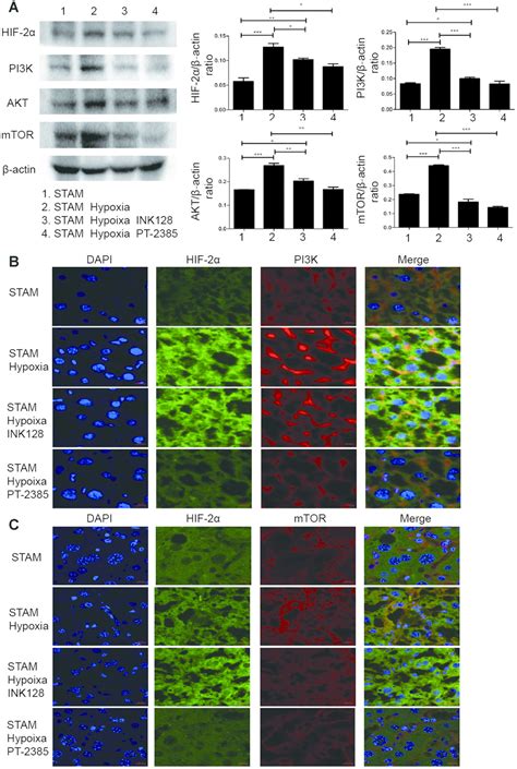 Hif 2α Upregulation Mediated By Hypoxia Promotes Nafld Hcc Progression