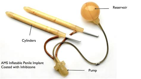 Penile Prosthesis Wessex Andrology