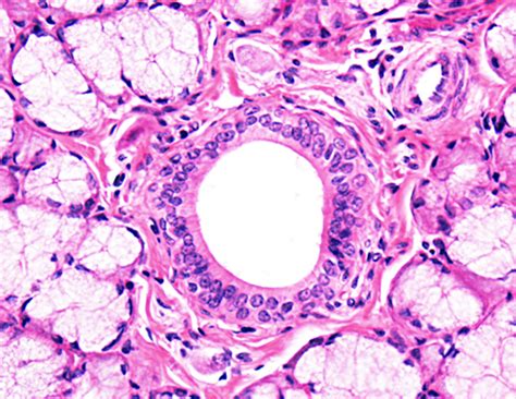 Tecido Epitelial Glandular Histologia The Best Porn Website