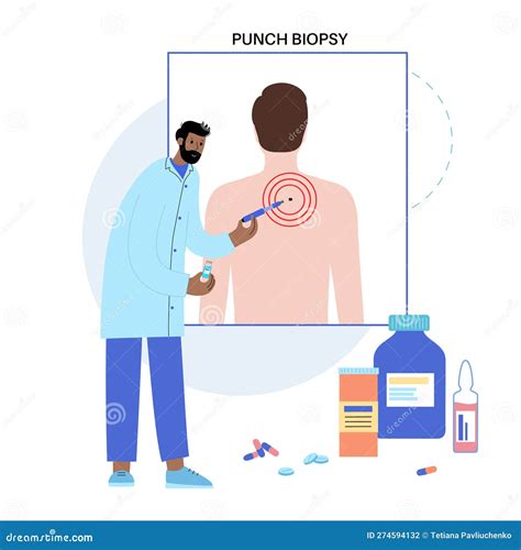 Punch Biopsy Procedure Stock Illustration Illustration Of Treatment