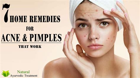 7 Home Remedies for Acne & Pimples that Work