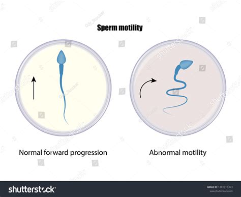 Low Sperm Count Images Stock Photos Vectors Shutterstock