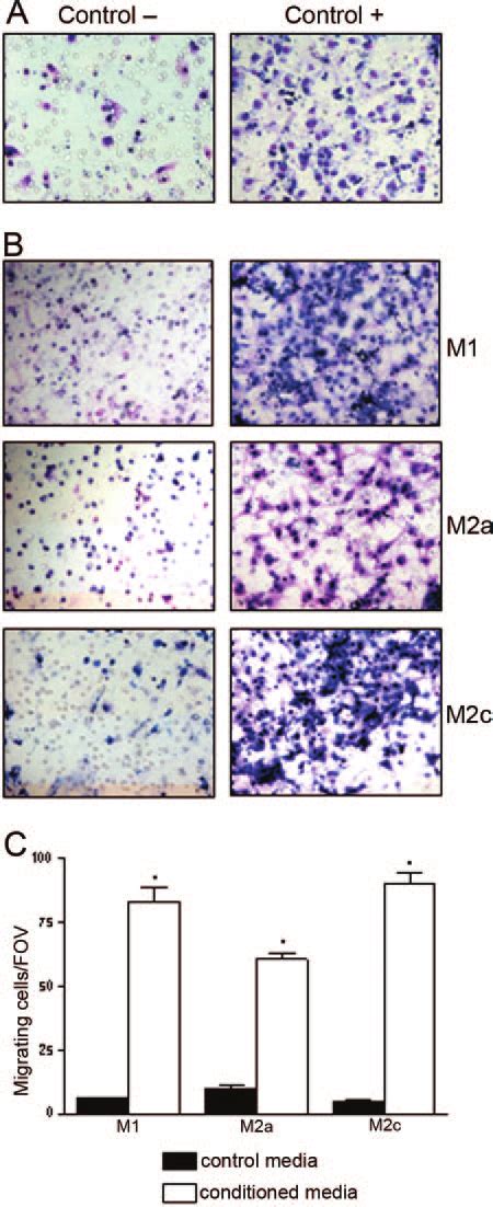 Macrophage Secreted Factors Induce Human Mesoangioblast Migration The