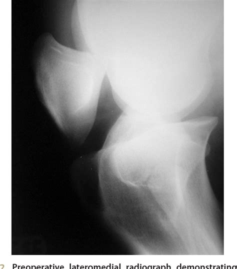 Figure 2 From Distal Luxation Of The Patella In A Horse Semantic Scholar