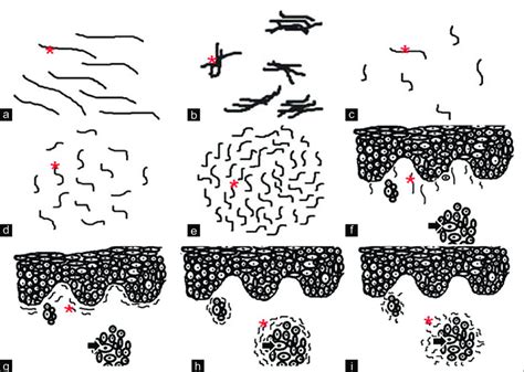 Patterns of elastic fibers. The figure depicts line diagrams of various... | Download Scientific ...