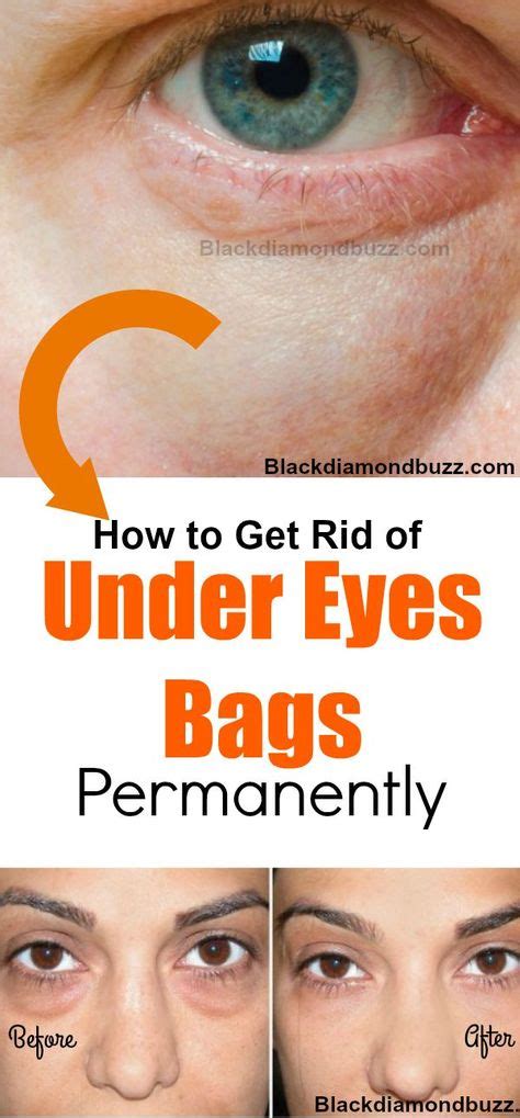 Under Eyes Home Remedies How To Get Rid Of Bags Under Eyes Overnight At Home Under Eye Bags