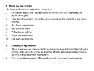 Endometriosis Ppt