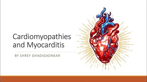 Cardiomyopathies And Myocarditis Youtube