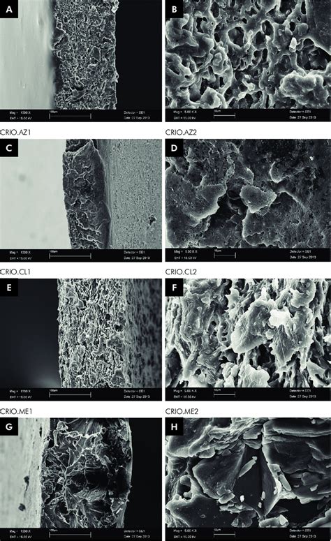 Freeze Fracture 1 1000 X And 2 500 Kx Download Scientific Diagram