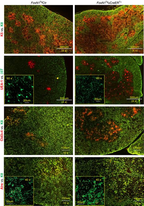 Overexpression Of Foxn1 Mediated By Ucreert In Juvenile Mice Induced