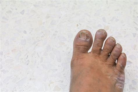 10 Common Foot Problems - Health & Detox & Vitamins