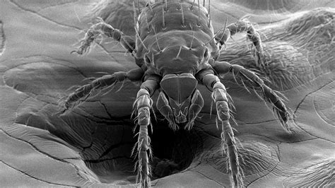 Bacterium Associated With Disease Found in N.C. Chiggers | NC State News