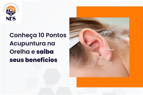 Conhe A Pontos Acupuntura Na Orelha E Saiba Os Benef Cios