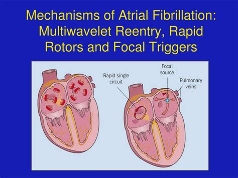 Ppt Update On The Treatment Of Atrial Fibrillation Powerpoint