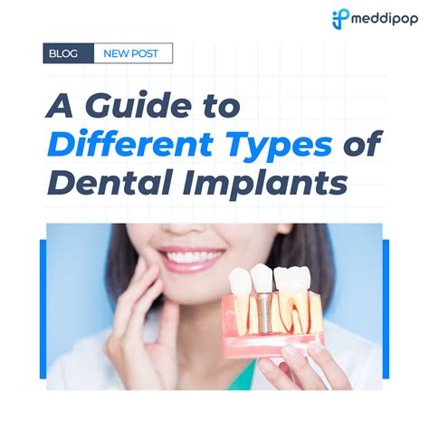 A Guide to Different Types of Dental Implants - MeddiPop