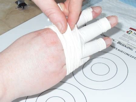 Wound of the Month: Degloving