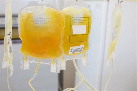 Il Plasma Iperimmune Efficace Per Combattere Il Covid