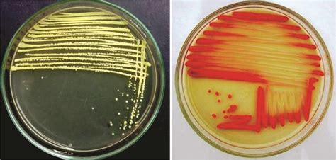 Purification Of Pigmented Bacterial Isolate By Streak Dilution