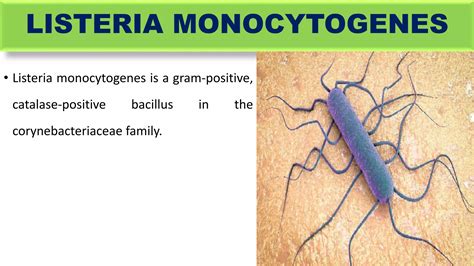 Maternal Infection During Pregnancy Ppt