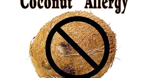 Free Posters and Signs: Coconut Allergy