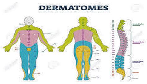 Descubre todo sobre el dermatoma qué es y cómo afecta a tu cuerpo