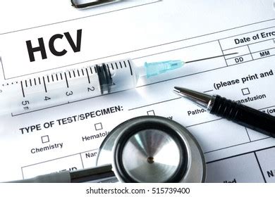 Hcv Medical Diagnosis Hcv Hepatitis C Stock Photo 515739400 | Shutterstock